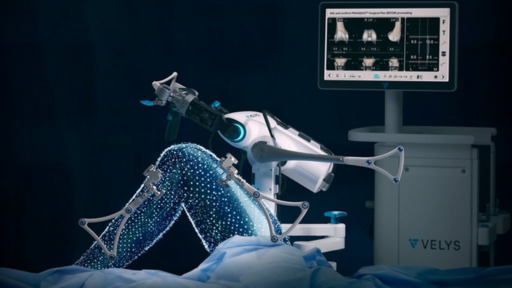 Knieroboter: Eine Revolution im Operationssaal