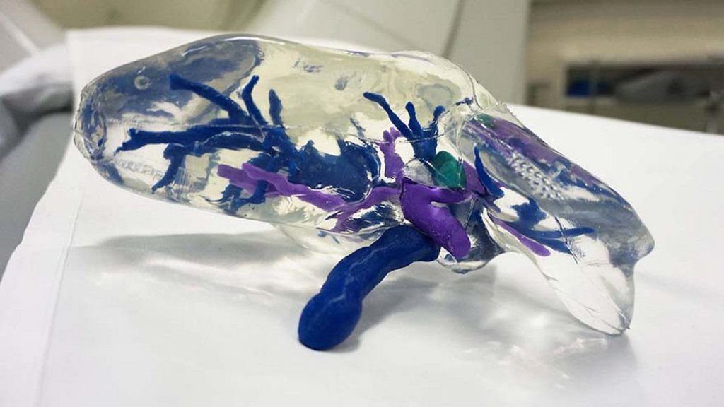 Publikation einer Studie zu MAIT-Abwehrzellen als Verbindung zwischen Darm und Leber