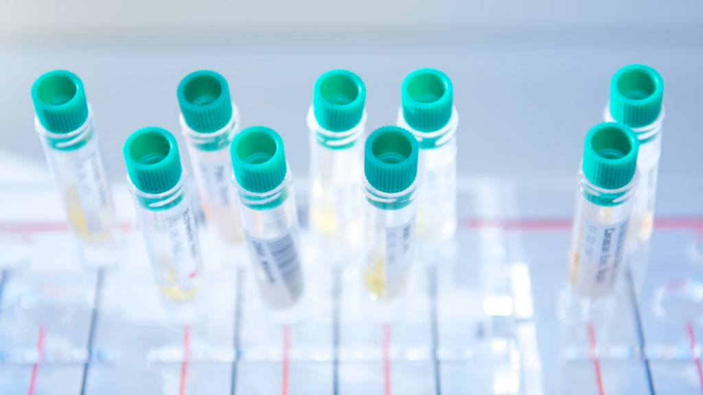 Erfolgreiche Akkreditierung der Zentrallaboratorien des Kantonsspitals Baselland