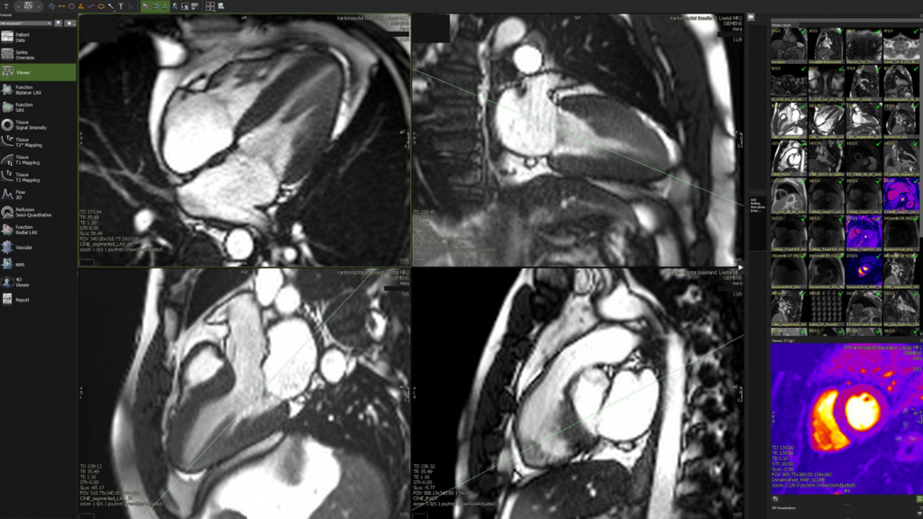 Prof. Dr. Dr. med. Deniz Bilcen erlangt das «European-Diploma in Cardiovascular Radiology»