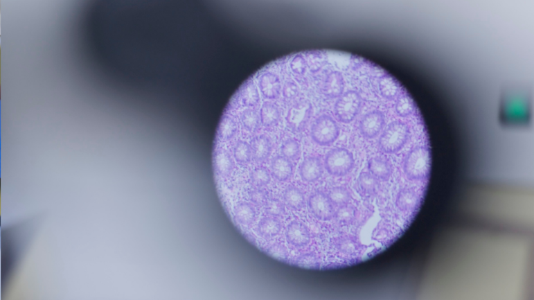 Pathologie in Liestal - wie gewohnt für die Zuweisenden da