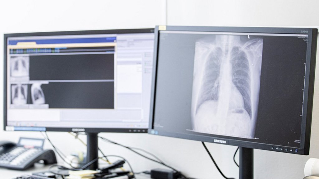 Studie: Inhaliertes Aviptadil zur Behandlung von COVID-19