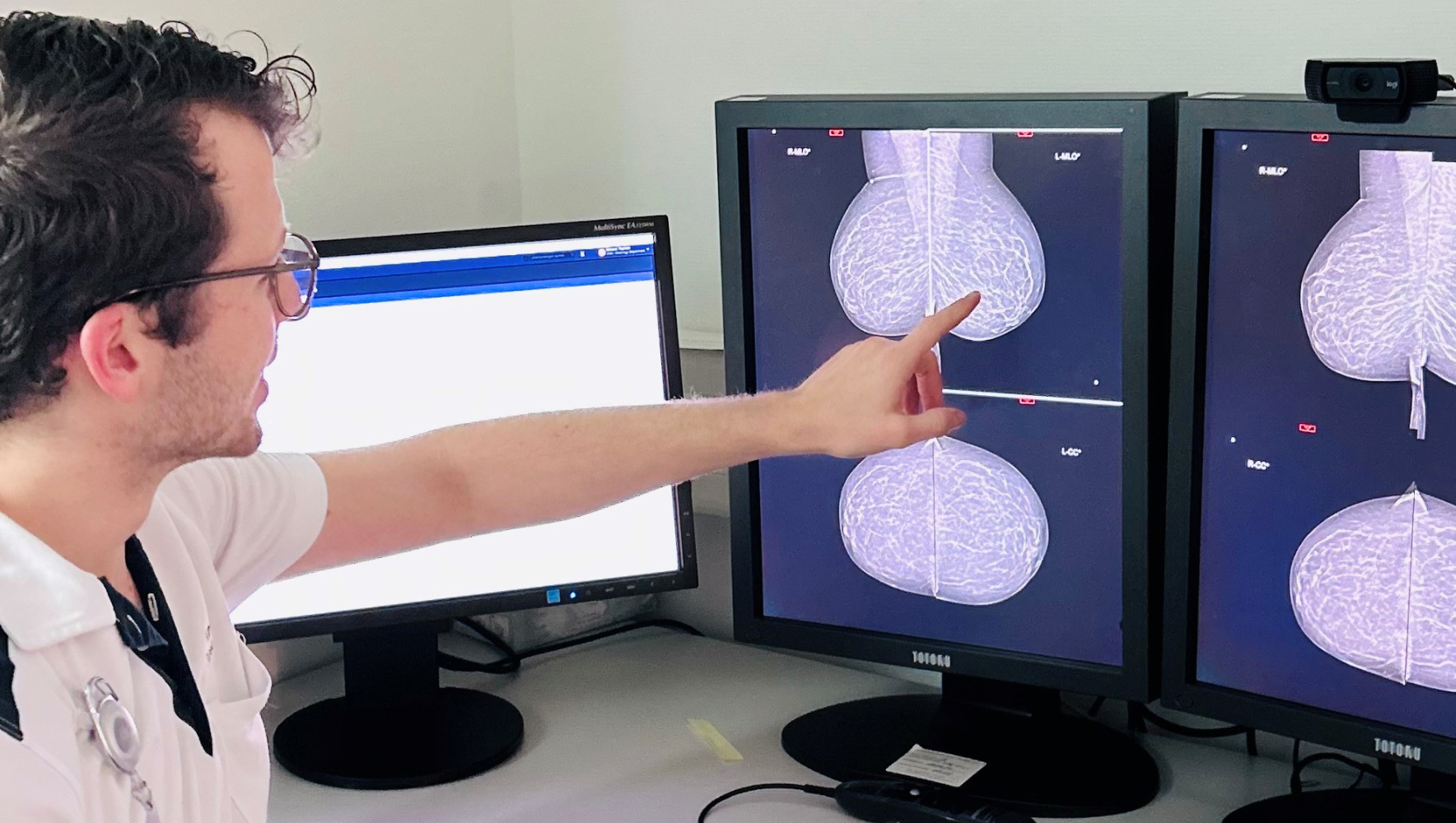 Dr. Raphael Sexauer erlangt das «European-Diploma in Breast Imaging»